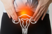 U xơ - u nang