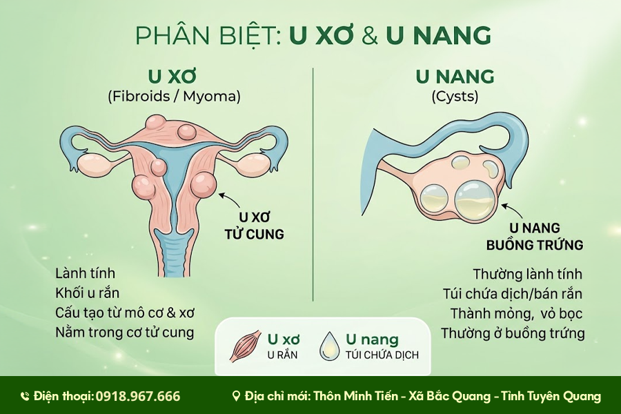 u xơ u nang là gì