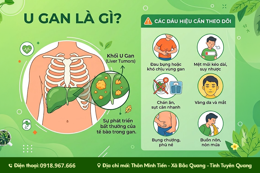 u gan và dấu hiệu cần theo dõi