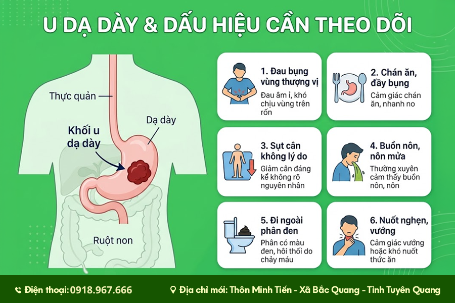 vị trí dạ dày trong cơ thể